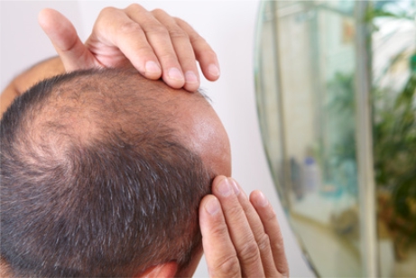 szampon na łysienie dla mężczyzn badania