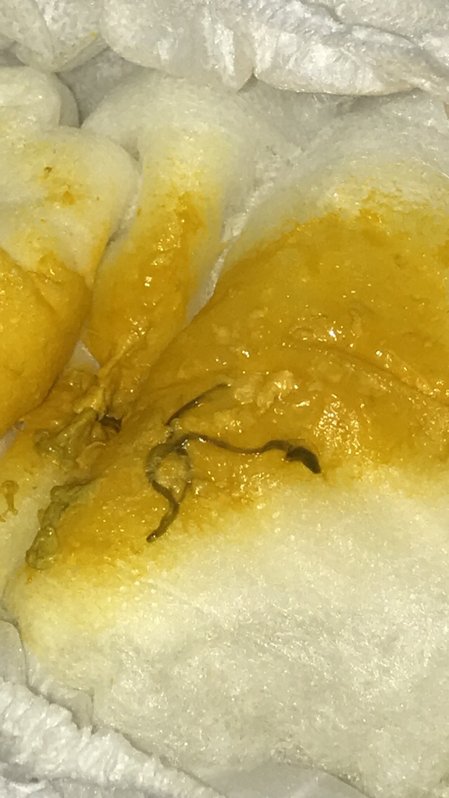 pinworm larvae in pampers