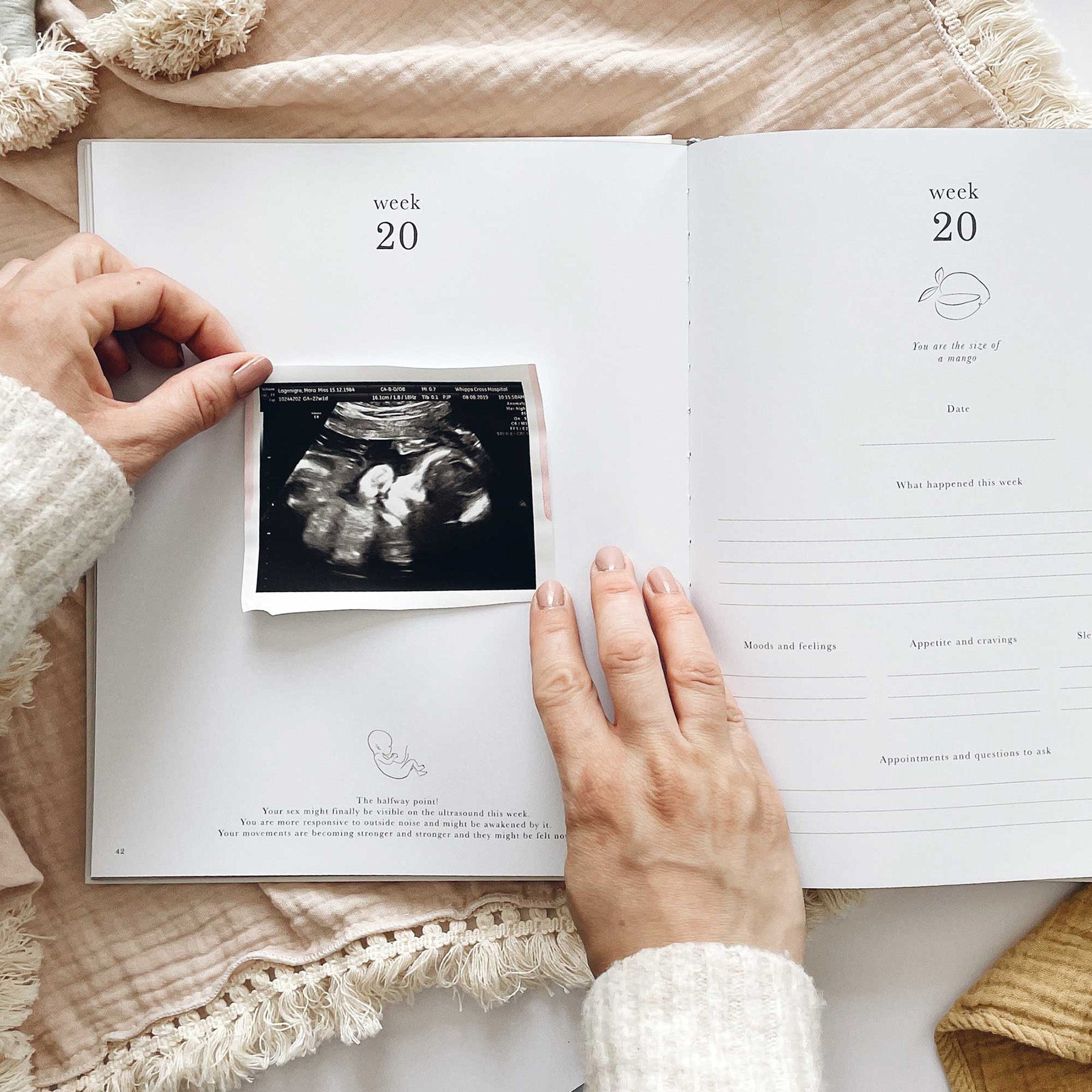 Pregnancy diary