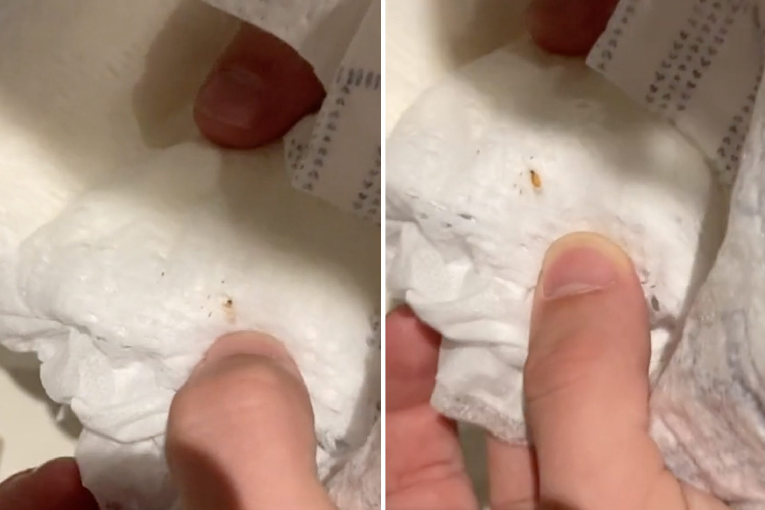pinworm larvae in pampers