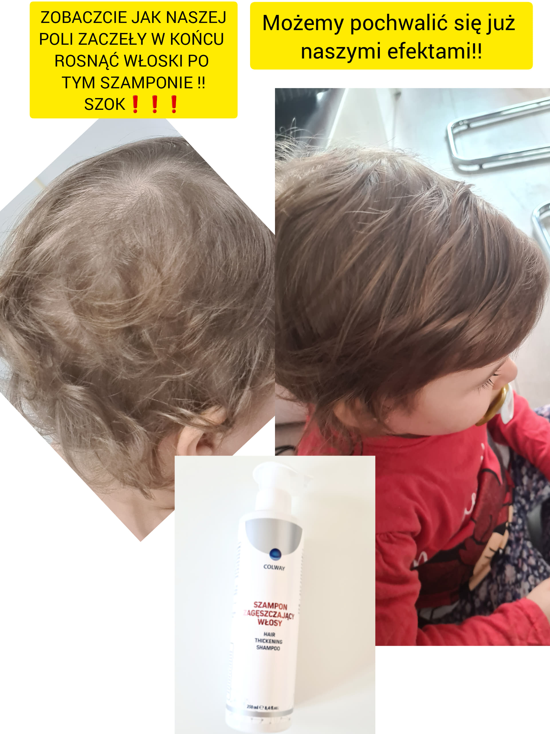 szampon na wypadanie włosów u dzieci